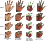 Volume Rendering of Human Hand Anatomy